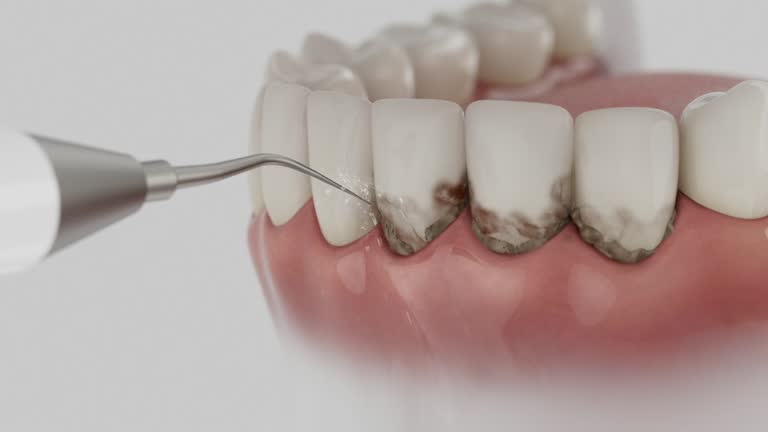 Reliable Dental contractor in Lehi, UT by Smile Center Dentistry